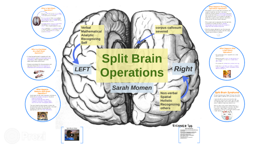 Split brain