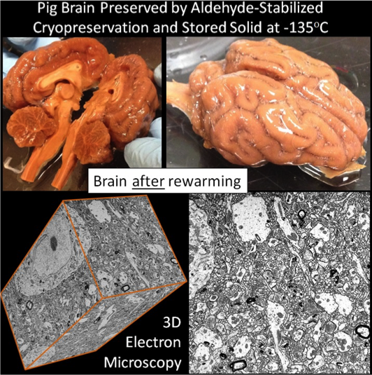 brain connectome